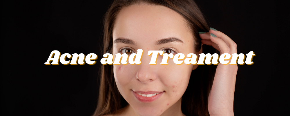 Acne treatment